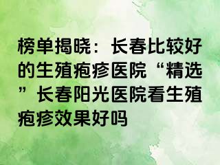 榜单揭晓：长春比较好的生殖疱疹医院“精选”长春阳光医院看生殖疱疹效果好吗