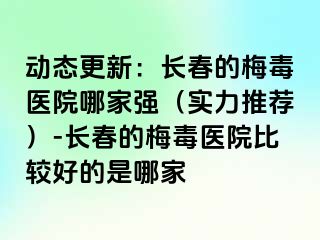 动态更新：长春的梅毒医院哪家强（实力推荐）-长春的梅毒医院比较好的是哪家