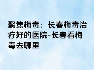 聚焦梅毒：长春梅毒治疗好的医院-长春看梅毒去哪里