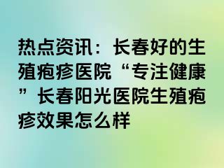 热点资讯：长春好的生殖疱疹医院“专注健康”长春阳光医院生殖疱疹效果怎么样