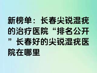 新榜单：长春尖锐湿疣的治疗医院“排名公开”长春好的尖锐湿疣医院在哪里