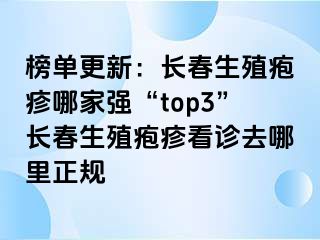 榜单更新：长春生殖疱疹哪家强“top3”长春生殖疱疹看诊去哪里正规