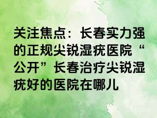 关注焦点：长春实力强的正规尖锐湿疣医院“公开”长春治疗尖锐湿疣好的医院在哪儿